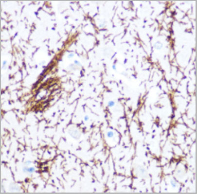 product-image-AAA10723_IHC6.jpg