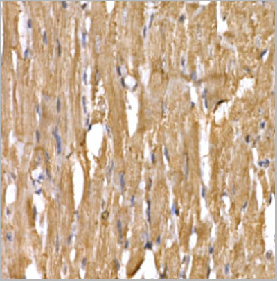 product-image-AAA10727_IHC4.jpg