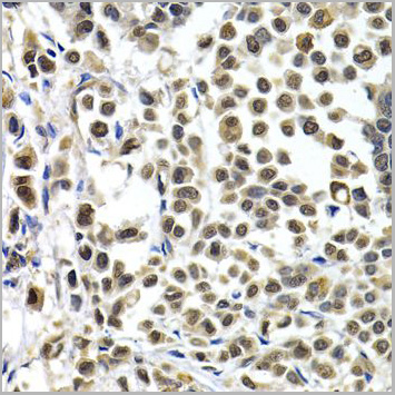 product-image-AAA10752_IHC2.jpg