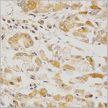 product-image-AAA10753_IHC3.jpg