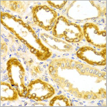product-image-AAA10753_IHC5.jpg