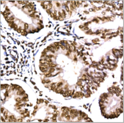 product-image-AAA10754_IHC2.jpg