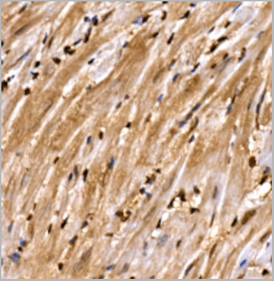product-image-AAA10754_IHC3.jpg
