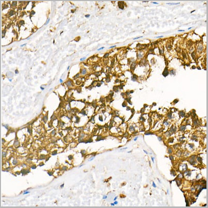 product-image-AAA10763_IHC2.jpg