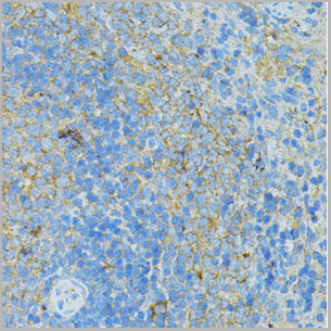 product-image-AAA10771_IHC2.jpg