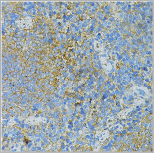 product-image-AAA10771_IHC3.jpg