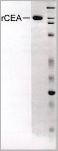 product-image-AAA10831_SDS_PAGE.jpg