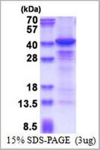 product-image-AAA10895_SDS_PAGE.jpg