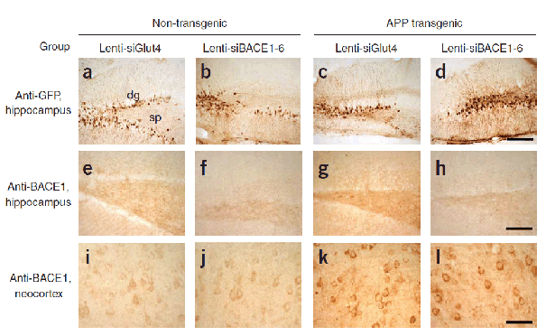 product-image-AAA10918_IHC7.gif
