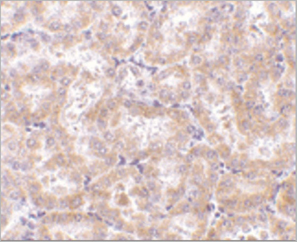 product-image-AAA10922_IHC4.jpg