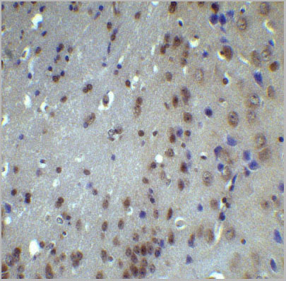 product-image-AAA10937_IHC7.jpg