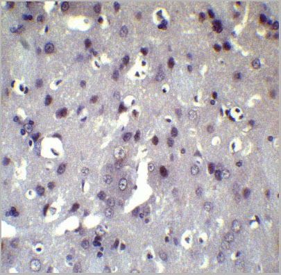 product-image-AAA10937_IHC8.jpg