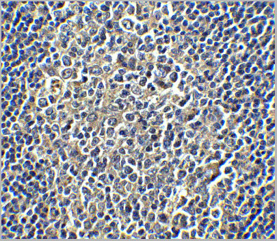 product-image-AAA10941_IHC5.jpg