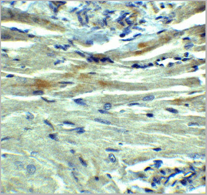 product-image-AAA10941_IHC8.jpg