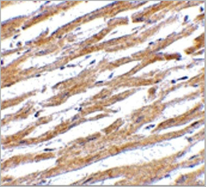 product-image-AAA10941_IHC9.jpg