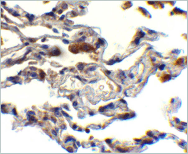 product-image-AAA10954_IHC2.jpg
