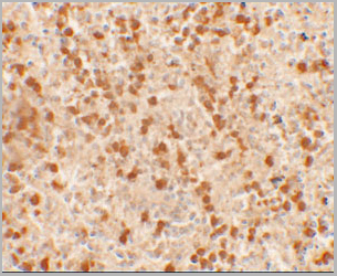 product-image-AAA10969_IHC2.jpg