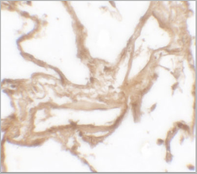 product-image-AAA10971_IHC2.jpg