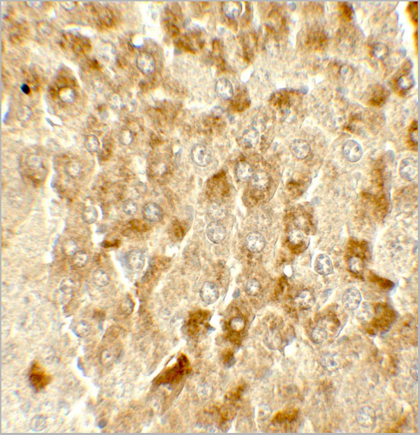 product-image-AAA10972_IHC2.jpg