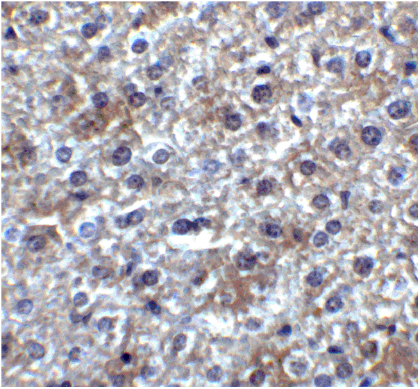 product-image-AAA10972_IHC5.gif