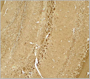 product-image-AAA10975_IHC2.jpg
