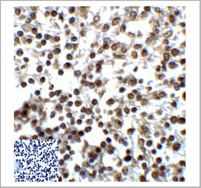 product-image-AAA11005_IHC7.jpg