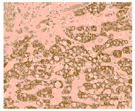product-image-AAA110070_IHC13.gif