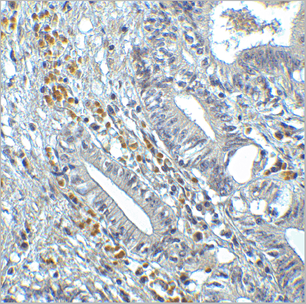 product-image-AAA11032_IHC7.gif