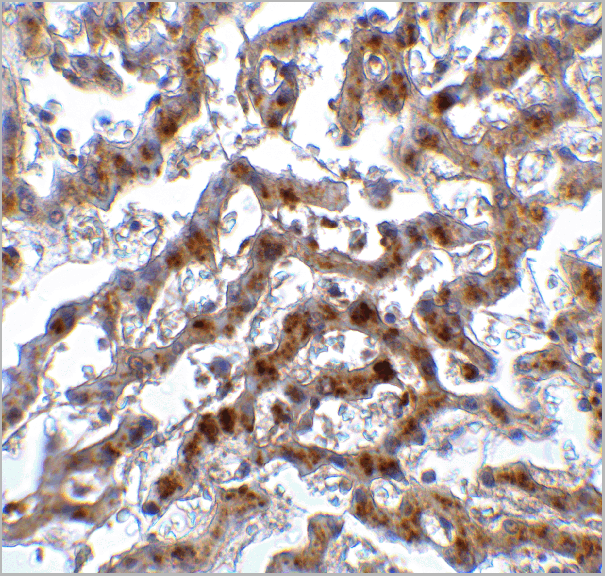 product-image-AAA11032_IHC8.gif