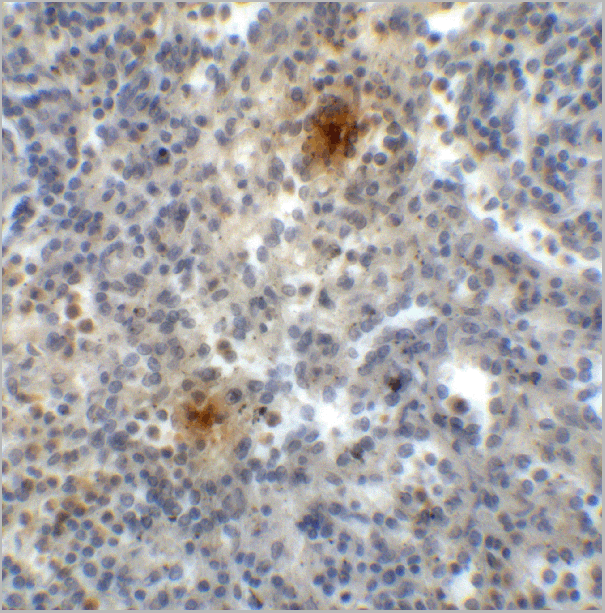 product-image-AAA11050_IHC5.gif