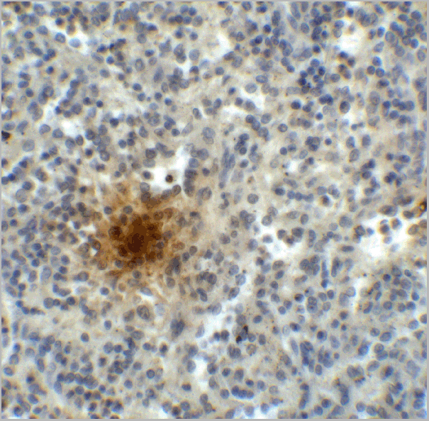 product-image-AAA11051_IHC5.gif