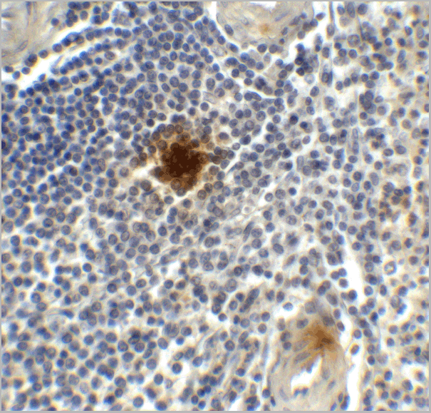 product-image-AAA11052_IHC5.gif