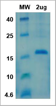 product-image-AAA11058_SDS_PAGE.jpg