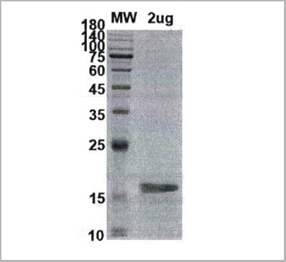 product-image-AAA11061_SDS_PAGE.jpg
