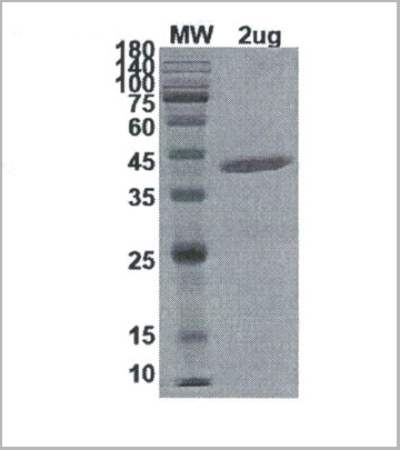 product-image-AAA11062_SDS_PAGE.jpg