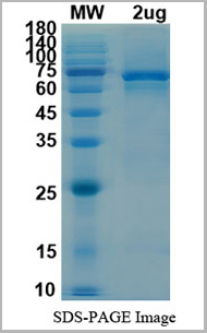 product-image-AAA11063_SDS_PAGE.jpg