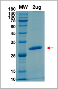 product-image-AAA11069_SDS_PAGE.png