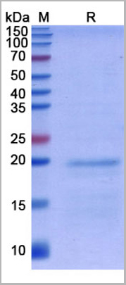 product-image-AAA11071_SDS_PAGE.jpg