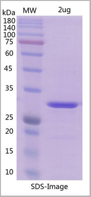 product-image-AAA11074_SDS_PAGE.jpg