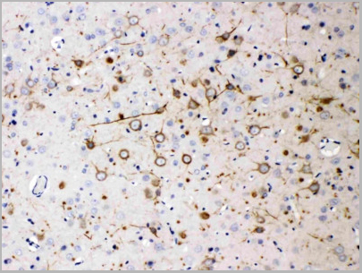product-image-AAA11507_IHC.jpg