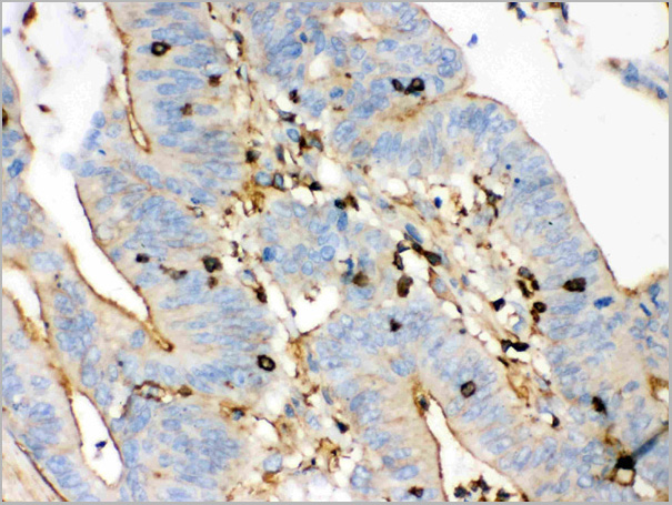 product-image-AAA11508_IHC5.jpg