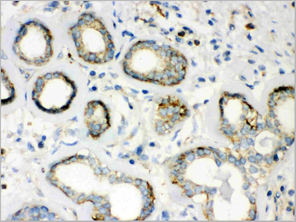 product-image-AAA11508_IHC6.jpg