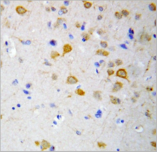 product-image-AAA11510_IHC2.jpg