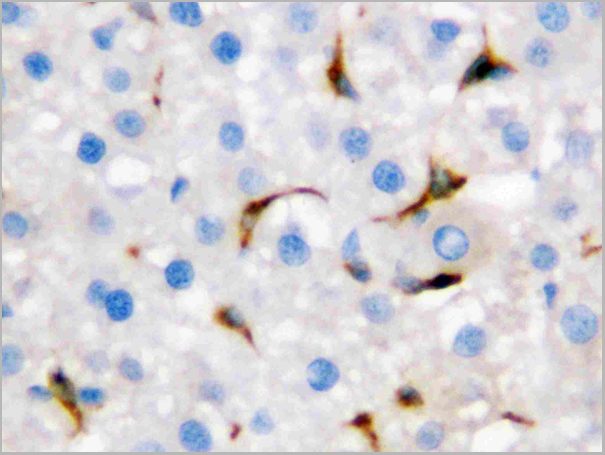 product-image-AAA11512_IHC2.jpg