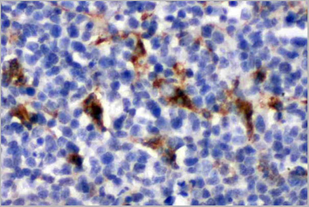product-image-AAA11512_IHC3.jpg