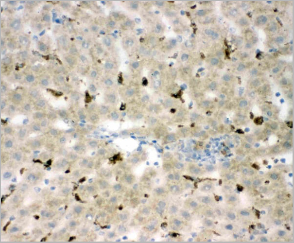 product-image-AAA11512_IHC4.jpg