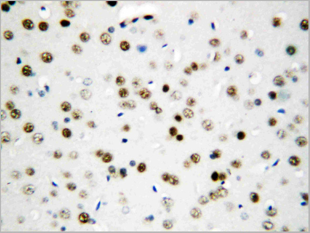product-image-AAA11519_IHC2.jpg