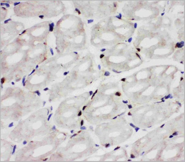product-image-AAA11519_IHC4.jpg