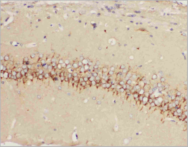 product-image-AAA11520_IHC2.jpg