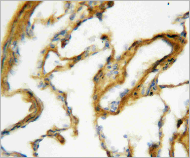 product-image-AAA11521_IHC2.jpg